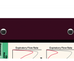 WhiteCoat Clipboard® Trifold - Wine Respiratory Therapy Edition